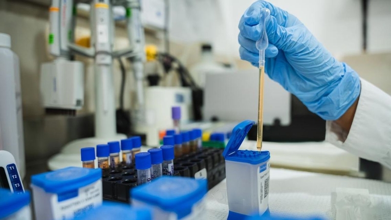 Xét nghiệm lao phổi giúp phát hiện sớm vi khuẩn lao, nâng cao hiệu quả điều trị